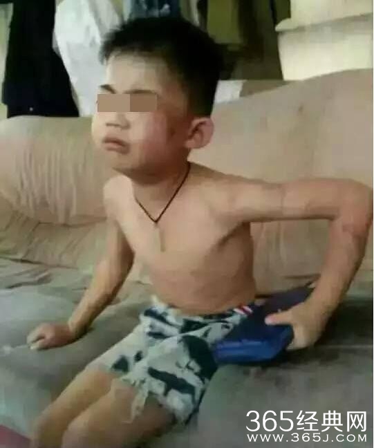 商丘男童遭家暴 施暴者获刑两年八个月