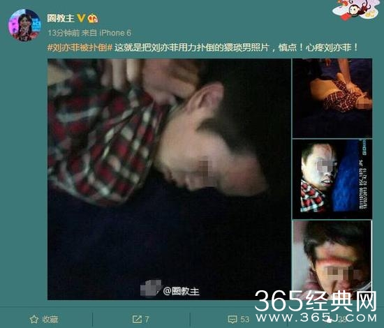 刘亦菲被男子扑倒四肢均有擦伤 肇事者自称粉丝