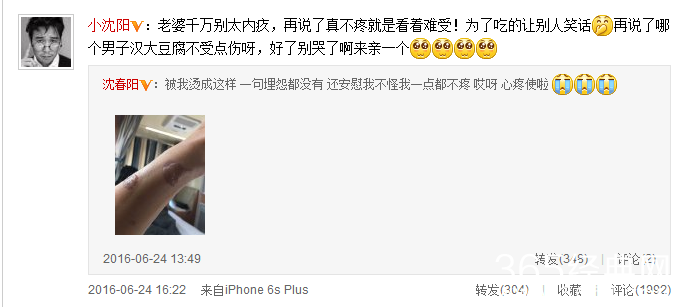 小沈阳被爱妻烫伤 安慰妻子别内疚