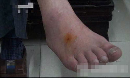 女孩被狗咬伤求赔偿 狗主人：有意见去咬狗