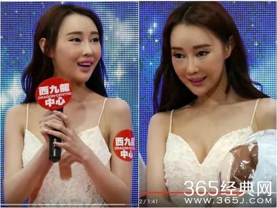 女星脸部僵硬坚称天然 自曝开价百万陪睡