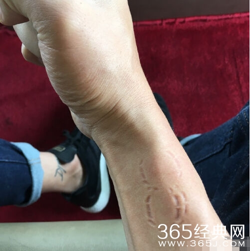 邓超哭诉小花妹妹咬他 网友笑称喜闻乐见