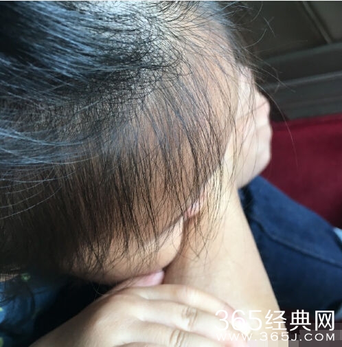 邓超哭诉小花妹妹咬他 网友笑称喜闻乐见