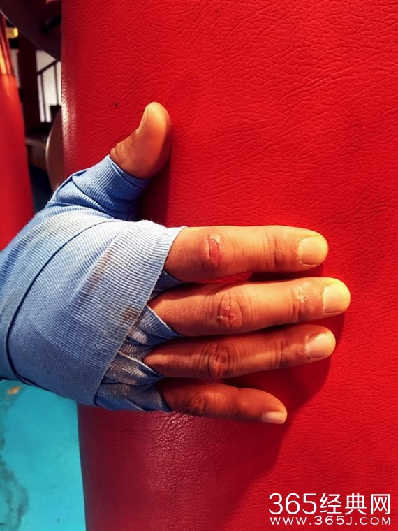 黄致列受伤坚持拍摄显敬业 新曲MV将上线