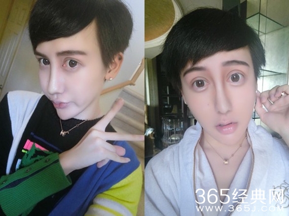 蛇精男承认整容 哭求医院不要因骚扰起诉