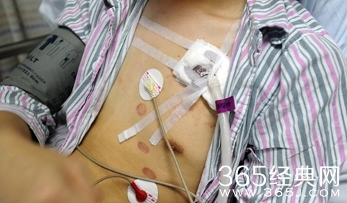 真球迷！他为主队呐喊竟吼破肺