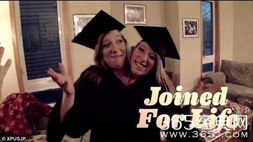 罕见“双头姐妹”共享一个身体 如今已大学毕业