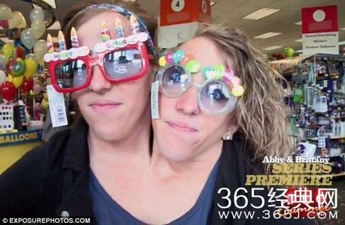 罕见“双头姐妹”共享一个身体 如今已大学毕业