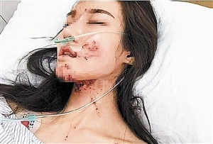 网红美女七夕坐宝马遭毁容 肇事司机逃逸