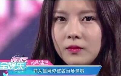 韩女星鼻子一捏就塌陷 难道不是整容事故