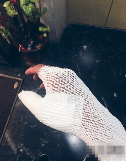 何润东大婚前夕手指脱臼 老婆制冰袋帮冷敷