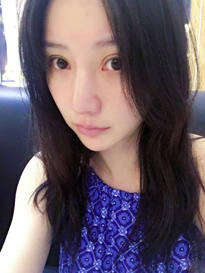 柳岩起床晒素颜照双眼皮明显 脸好像又变了