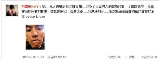 颜值崩塌？柯震东晒满脸爆痘照回应：大过敏