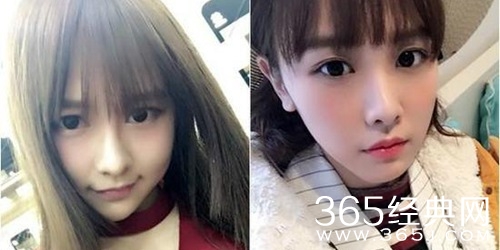 唐安琪复健落泪：会冲破阻碍 让伤疤成勋章