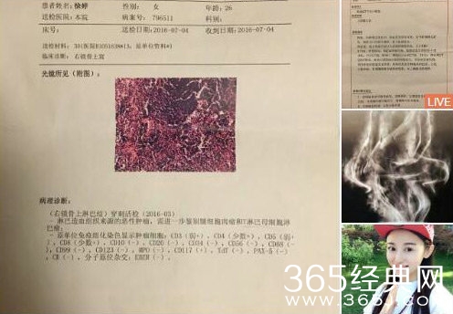 演员徐婷患淋巴癌去世 翁虹等人曾发微博求助