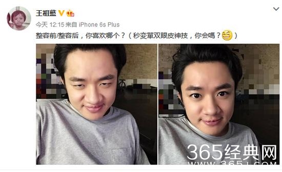 整容前整容后？王祖蓝自拍做鬼脸前后判若两人