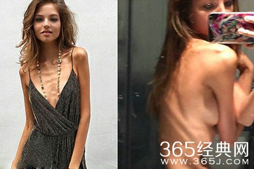 嫩模瘦成皮包骨 为证明没病晒吃饭照片