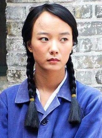 王思聪前女友额头肿胀瞩目，原来电视剧一不小心也能鉴定整容