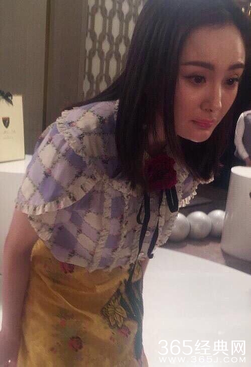 王思聪前女友额头肿胀瞩目，原来电视剧一不小心也能鉴定整容