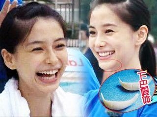 王思聪前女友额头肿胀瞩目，原来电视剧一不小心也能鉴定整容