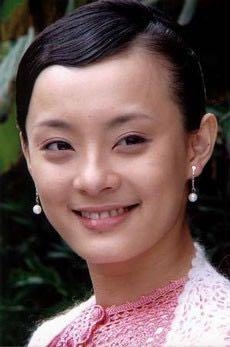 王思聪前女友额头肿胀瞩目，原来电视剧一不小心也能鉴定整容