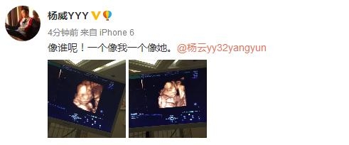 恭喜！杨威晒杨云腹中胎儿B超照，证实老婆所怀的为龙凤胎