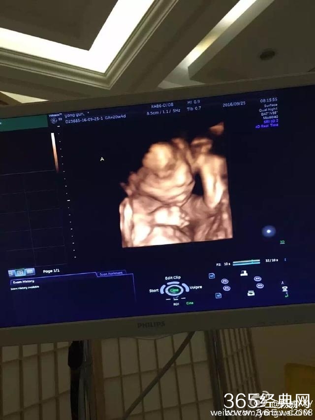 恭喜！杨威晒杨云腹中胎儿B超照，证实老婆所怀的为龙凤胎