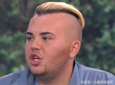 迷弟花重金欲整容成贝克汉姆 来看图！两万英镑白瞎了不？