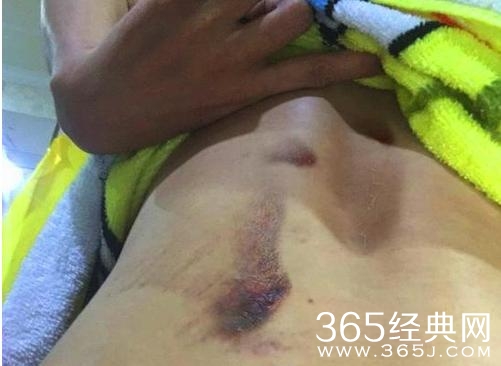 真相大白，坠崖G女演员，炒作博同情令人恶心