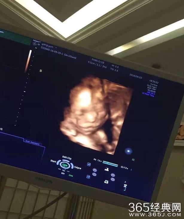 黄多多长成大美女 妹妹曝光好可爱，森碟的弟弟也炒鸡帅！明星二胎宝宝们你们是复制粘贴的啊？