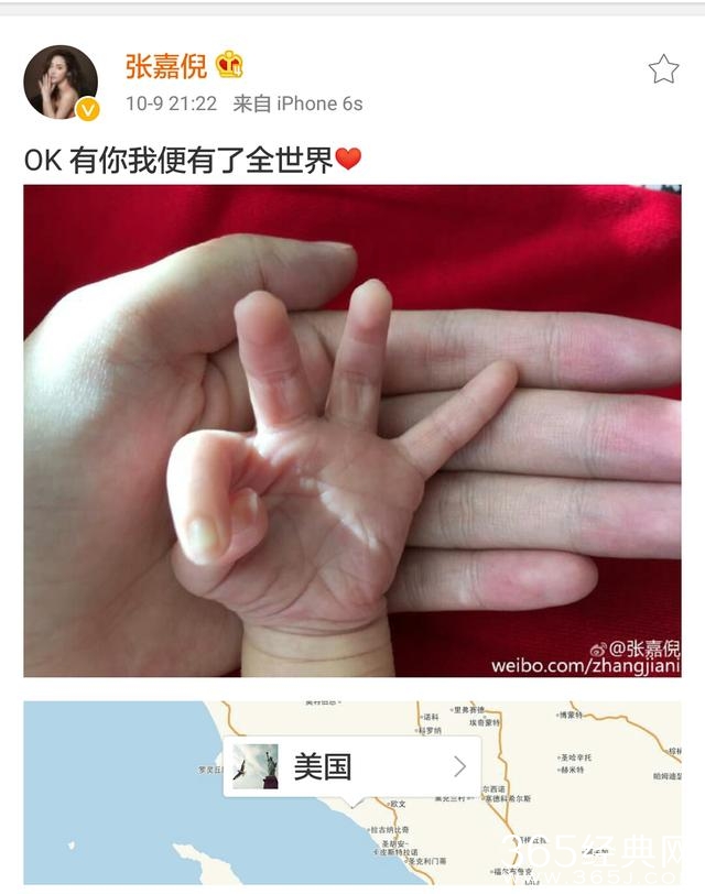 张嘉倪在美国顺利生产，晒宝宝小手照，网友大呼太突然
