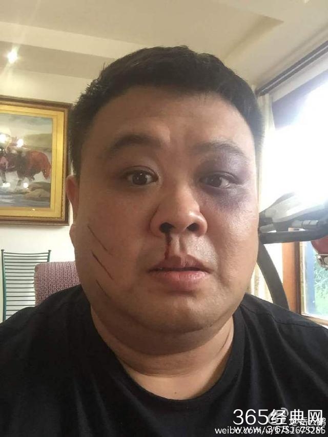 孙越过生日，岳云鹏发奇葩祝福！遭网友吐槽！