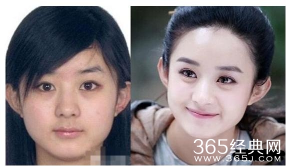 这些明星越长越好看，最后一个确定没有整容？