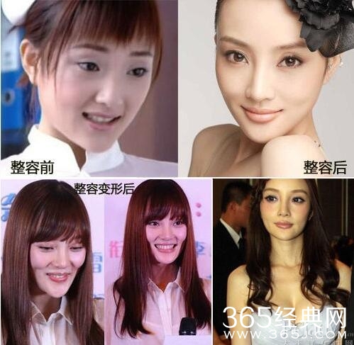 同样是整容为何胡歌郑爽整容不被骂，而她却永久不能翻身