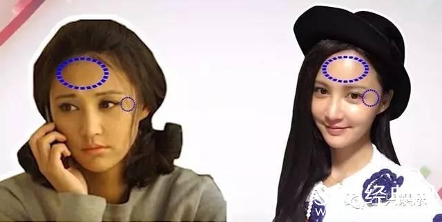 袁弘护妻没错，可张歆艺确实是整了啊