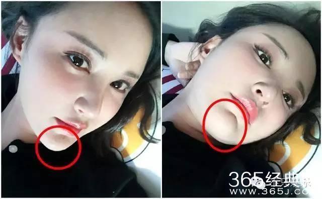 袁弘护妻没错，可张歆艺确实是整了啊