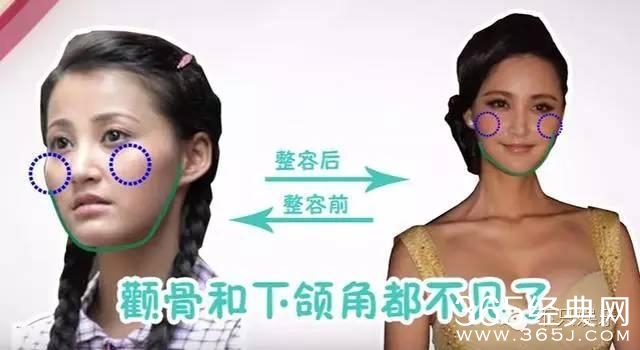 袁弘护妻没错，可张歆艺确实是整了啊