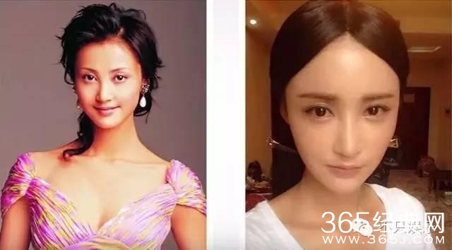 袁弘护妻没错，可张歆艺确实是整了啊