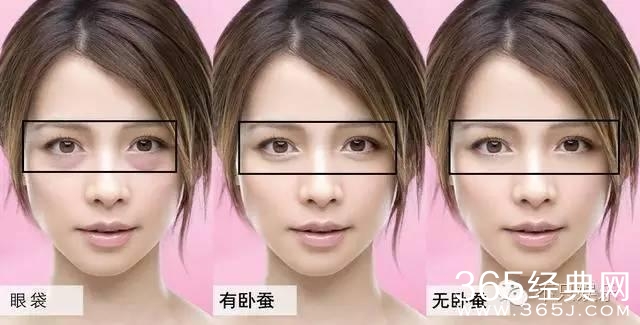 袁弘护妻没错，可张歆艺确实是整了啊