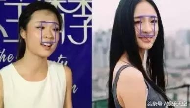 沈梦辰根本不算什么，整容炒作小能手还得看李莎旻子