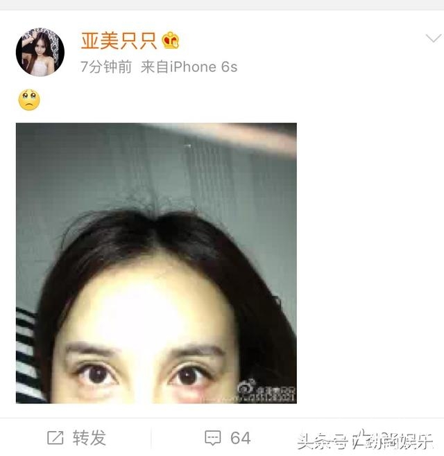 亚美只只疑似爆发整容后遗症 网友不仅污而且幸灾乐祸