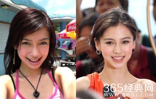 赵雅芝脸上这一明显缺陷，竟然直到她老了我们才发现