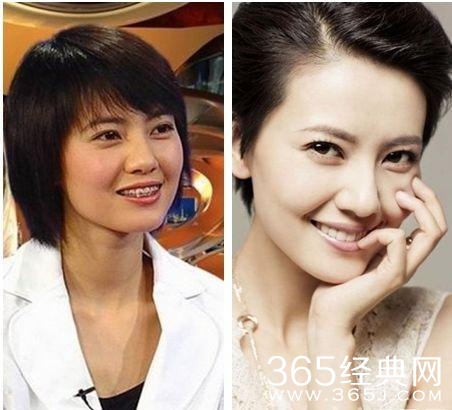 赵雅芝脸上这一明显缺陷，竟然直到她老了我们才发现