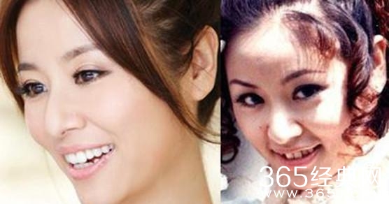 赵雅芝脸上这一明显缺陷，竟然直到她老了我们才发现