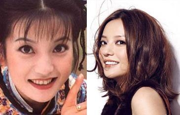 赵雅芝脸上这一明显缺陷，竟然直到她老了我们才发现