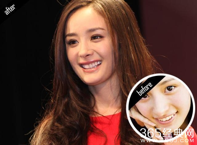 赵雅芝脸上这一明显缺陷，竟然直到她老了我们才发现