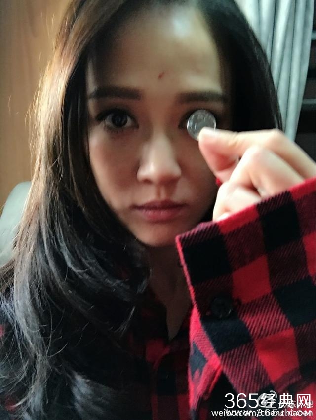 陈乔恩晒钱币眼，自己把额头抓伤了