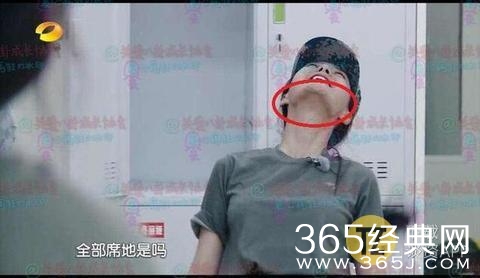 妈呀！沈梦辰下巴里的白色异物是什么，难道是假体？！