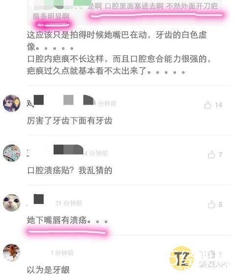 妈呀！沈梦辰下巴里的白色异物是什么，难道是假体？！