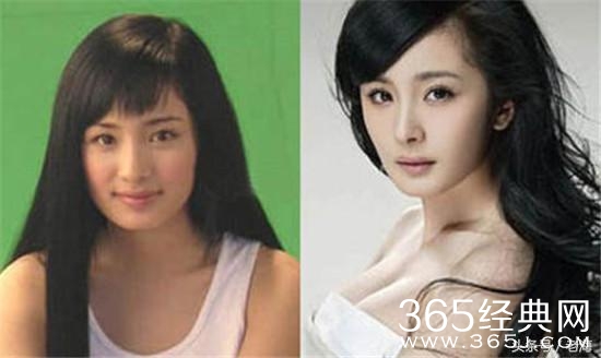 冯小刚拒绝整容脸，半个娱乐圈都被砍了？